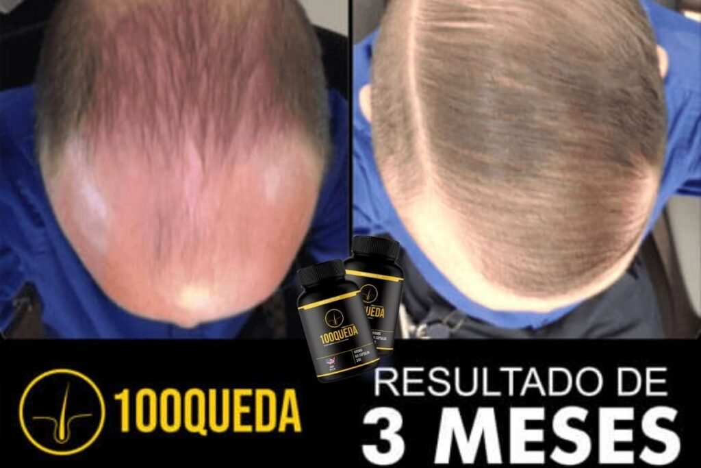 100queda